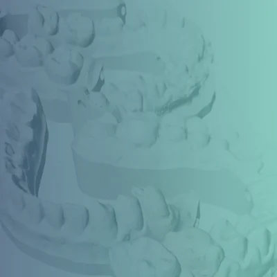 Soluções digitais CAD/CAM e fresagem para dentistas e protéticos